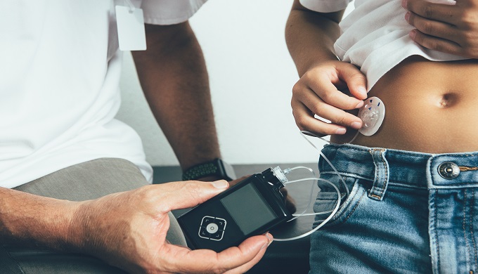 Diabetic child applying an insulin pump dressing in his abdomen with the doctor in the clinic