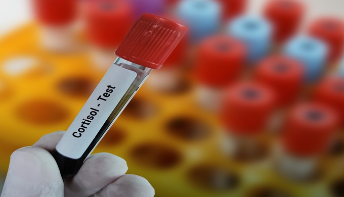 Lab Technologist holds blood sample for Cortisol test with laboratory background.